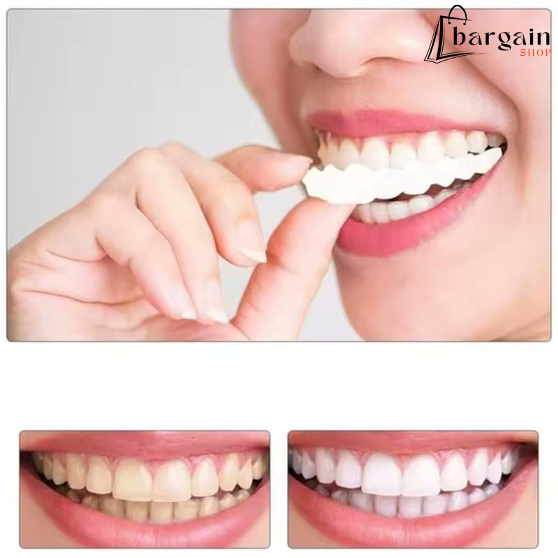 Holivudski osmijeh - umjetna zubna proteza