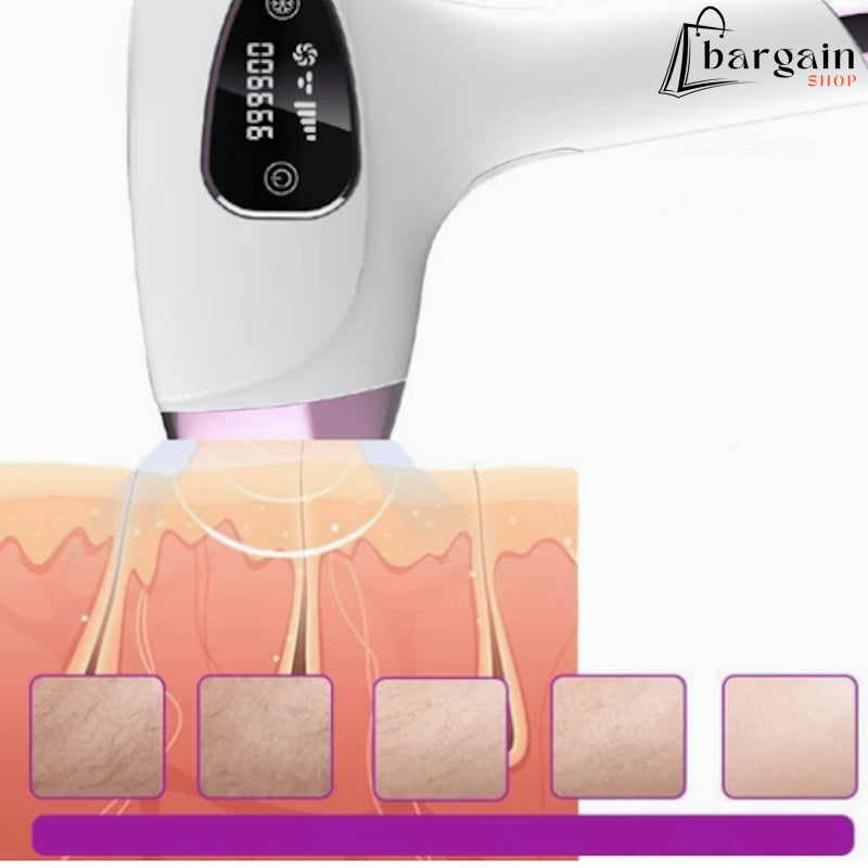 Laserski epilator za uklanjanje dlačica